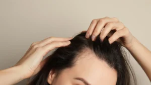 why scalp health matters so much